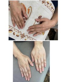 تصویر کرم جوانساز دست یارا 