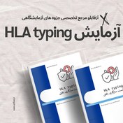 تصویر آزمایش HLA typing (تست سازگاری بافتی) 