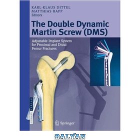 تصویر دانلود کتاب The Double Dynamic Martin Screw (DMS): Adjustable Implant System for Proximal and Distal Femur Fractures پیچ مارتین داینامیک دوبل (DMS): سیستم ایمپلنت قابل تنظیم برای شکستگی های پروگزیمال و دیستال استخوان ران