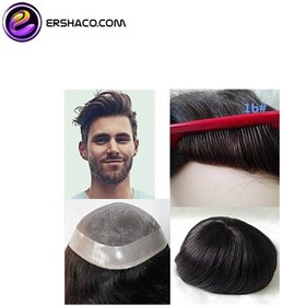 تصویر پروتز مو طبیعی بالای سر مردانه لس آنجلس (کد:8017) - 15*20 Men's overhead hair prosthesis(code:8017)