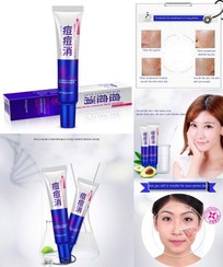 تصویر کرم تیوپی درمانی ضد جوش و آکنه اورژانسی 