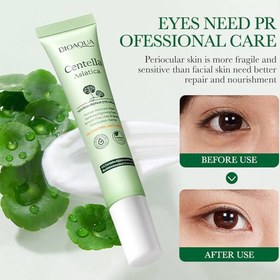 تصویر کرم دورچشم سنتلا 