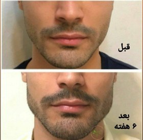 تصویر دستگاه زاویه ساز صورت 