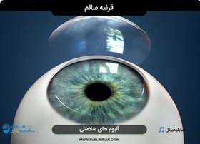 تصویر تقویت قرنیه نازک 