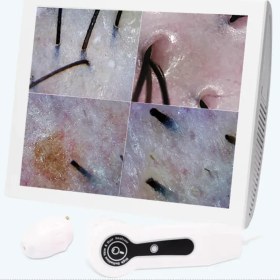 تصویر آنالیزور پوست و مو مدل BD-152A 