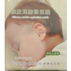 تصویر چسب اصلاح فرم گوش نوزاد 