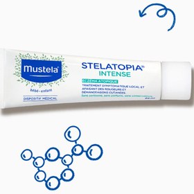 تصویر کرم درمانی اگزما استلاتوپیا اینتنس موستلا ۳۰میل Stelatopia intense mustela 30mil