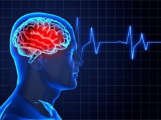 تصویر دانلود پوستر مدیریت سکته مغزی حاد (Stroke) بر اساس گایدلاین سال ۲۰۲۰ انجمن قلب آمریکا 