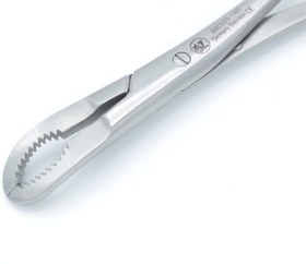 تصویر استخوان گیر ریجید 