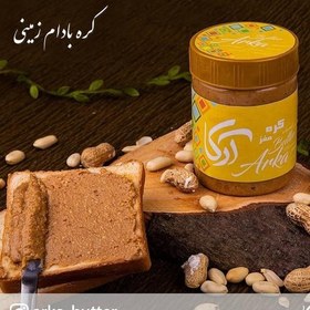 تصویر کره مغزیجات. 