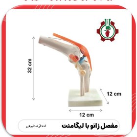 تصویر مولاژ مفصل زانو با نمایش رباط ها Molage of the knee joint with ligaments