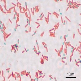 تصویر باسیلوس سرئوس Bacillus cereus Bacillus cereus