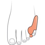 تصویر پد فاصله دهنده و ضد پینه با ساپورت انگشت کوچک اوتسی کد TF 06 Silicone Little Toe Separator TF06