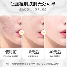 تصویر صابون ضد لک /صابون ضد جوش / صابون پنیر 