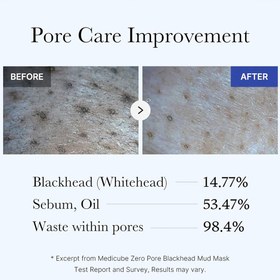 تصویر ماسک ضد جوش سرسیاه مدی کیوب Medicube Zero Pore Blackhead Mud Mask