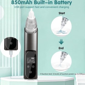 تصویر ساکشن گوش ( جرم گیر گوش ) 