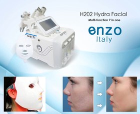 تصویر دستگاه هیدروفیشیال ۷ کاره موتور سنگین نیوفیس 