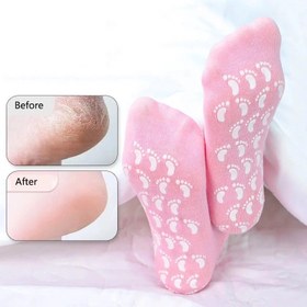 تصویر جوراب سیلیکونی مخصوص ترک پا - بنفش spa gel socks