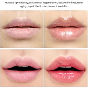 تصویر برق لب حرارتی عروسکی 