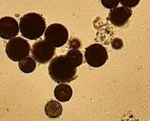 تصویر استوک هماتوکوکوس پلوویالیس haematococcus pluvialis 