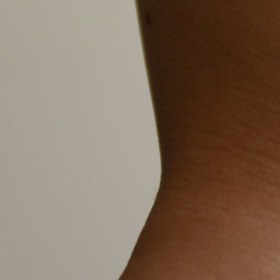 تصویر ماست بدن 