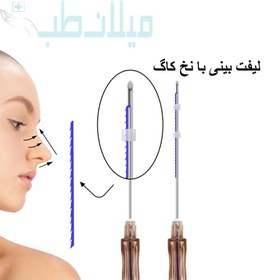 تصویر نخ لیفت بینی برند مدیلیفت مدل کاگ سایز G19.8mm 