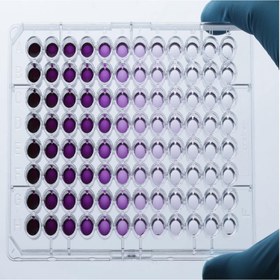 تصویر تست رزازورین Resazurin Resazurine test