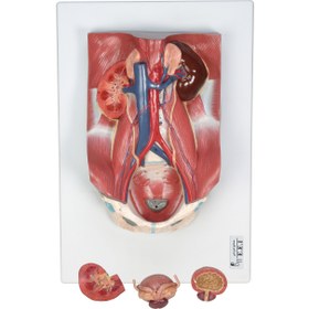 تصویر مولاژ دستگاه کلیه و دفع ادراری ا Modeling of kidney and urinary tract Modeling of kidney and urinary tract