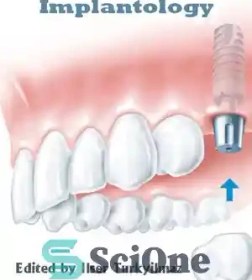 خرید و قیمت دانلود کتاب Current Concepts in Dental Implantology ...