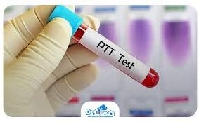 تصویر A PTT انعقادی(10 ویال 5 سی سی) A PTT(10*5ML)
