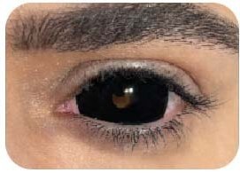 تصویر لنز فانتزی مشکی درشت (بزرگ) اُپتی کالر 