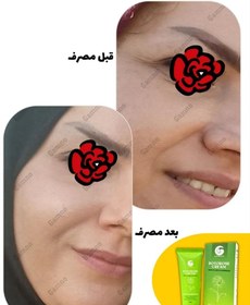 تصویر بوتورز کرم ضدچین و چروک و بوتاکس صورت گامنو/ برطرف کننده چروک عمیق صورت حجم دهی دائمی صورت و گونه ها جوانساز فوق العاده پوست کلاژن ساز و تحریک پوست برای کلاژن سازی لیفتینگ پوست برطرف کننده خط اخم و لبخنده روشن کننده و شفاف کننده پوست BOTOROSE CREAM