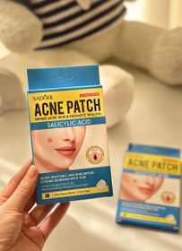 تصویر چسب جوش سادور 