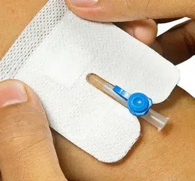 تصویر چسب انژیوکت 