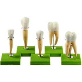 تصویر مولاژ دندان داندانپزشکی ۵ عددی 