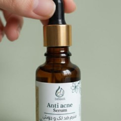 تصویر سرم ضد لک و جوش 