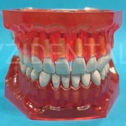 تصویر ماکت دندان فاندوم چانه