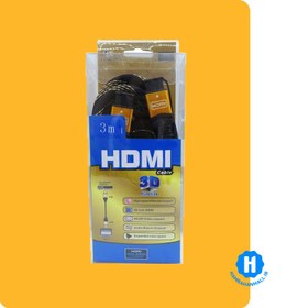 تصویر کابل HDMI فرانت 