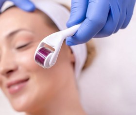 تصویر درمارولر تیتانیوم ۱ میلیمتر خانگی 