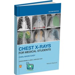 تصویر کتاب Chest X-Rays for Medical Students 2 edition 