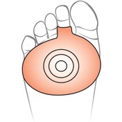 تصویر پد متاتارسال اوتسی مدل TM34 سیلیکونی 