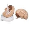 تصویر مدل (مولاژ) مغز دو تکه 