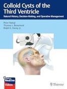 تصویر دانلود کتاب Colloid Cysts of the Third Ventricle: Natural History, Decision-Making, and Operative Management 1st Edition + Video 