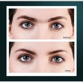 تصویر موزن اکلیلی دوکاره 