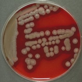 تصویر باسیلوس سرئوس Bacillus cereus Bacillus cereus