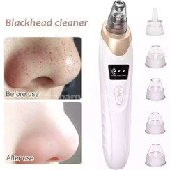 تصویر دستگاه پاکسازی پوست صورت و فیشیال میکرودرم پلاس 