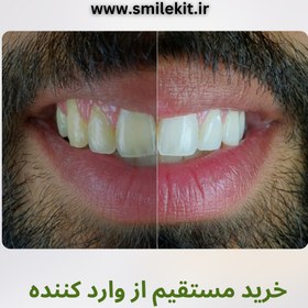 تصویر خمیر دندان سفیدکننده smilekit v34 اورجینال (2024)(پیشنهادی) smilekit v34 color corrector original 2024 (recommended)