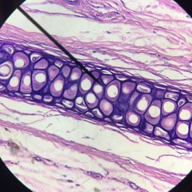 تصویر لام میکروسکوپی غضروف الاستیک (آموزشی) Microscopic slide of elastic cartilage (educational)