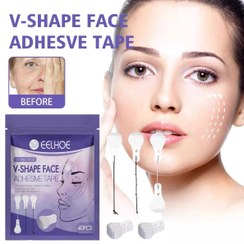 تصویر کیت لیفت صورت اورجینال Eelhoe 