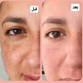 تصویر کرم ضد لک لاکچری کوین حجم ۵۰ میلی لیتر 